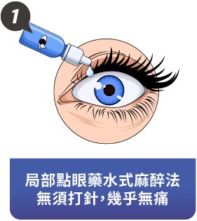 什麼是LEX全視清老花雷射